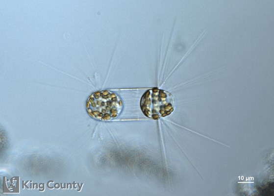 Photo of Corethron hystrix